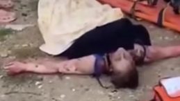 "Kıskan&ccedil;lıktan yaptım" dedi, alevlerden y&uuml;r&uuml;yerek &ccedil;ıkan adam hayatını kaybetti