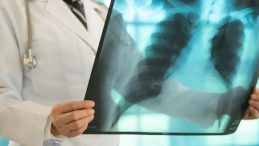 Sadece içeni değil çevresini de zehirliyor! Uzmandan uyarı: "Akciğer kanserinde görünmez tehlike"