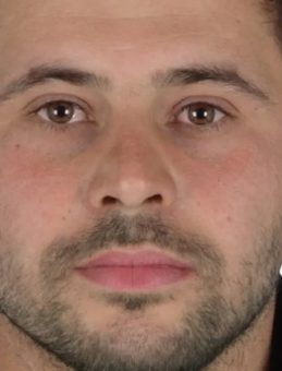 Sivas’ta Silahlı Kavga: İki Kişi Hayatını Kaybetti