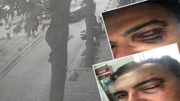 Sokakta Kedi Besleyen İş İnsanına G&uuml;peg&uuml;nd&uuml;z Saldırı