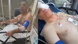 Sokakta Pompalı Tüfekle Dehşet Saçtı: 1'i Polis 4 Yaralı