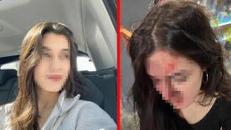 SON DAKİKA: Eski arkadaşın saldırısı! G&ouml;r&uuml;şelim diye &ccedil;ağırdı, feci şekilde darbetti! Gen&ccedil; kadın son halini paylaştı