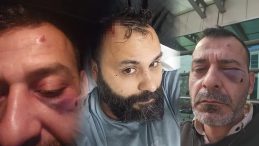 SON DAKİKA&hellip; Sosyal medya fenomeni Adem Ocaktan ağır şekilde darp edildi! Korkun&ccedil; anlar kameraya yansıdı: Kafasına 17 dikiş atıldı!