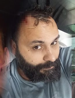 SON DAKİKA… Sosyal medya fenomeni Adem Ocaktan ağır şekilde darp edildi! Korkunç anlar kameraya yansıdı: Kafasına 17 dikiş atıldı!