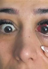 Tavuk yedi, g&ouml;z&uuml; kanlandı