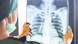 Zatürre Uyarısı: ‘Beşinci Ölüm Nedeni’