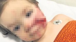 Acılı Baba İsyan Etti: Ben &Ouml;pmeye Kıyamıyordum