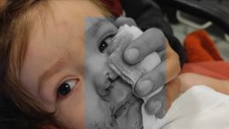 Ankara'da İki Kardeş Pitbull Saldırısına Uğradı: 1.5 Yaşındaki Efe Taburcu Oldu