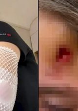 Anne ve Kızına Ters Y&ouml;nden Gelen Skuter &Ccedil;arptı