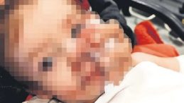 Apartmanda Pitbull Korkusu