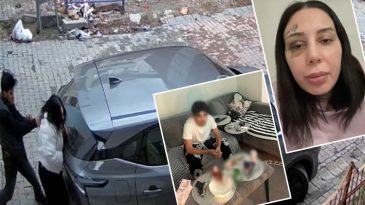 Burun Estetiği İ&ccedil;in Para İstedi, Eşini &Ouml;ld&uuml;resiye Darp Etti