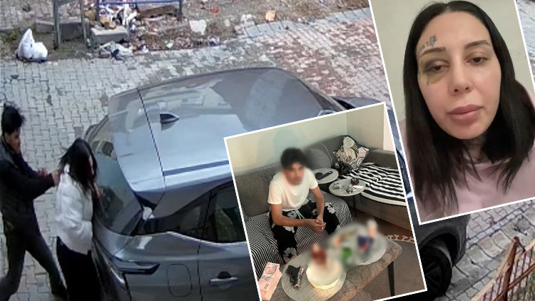 Burun Estetiği İ&ccedil;in Para İstedi, Eşini &Ouml;ld&uuml;resiye Darp Etti