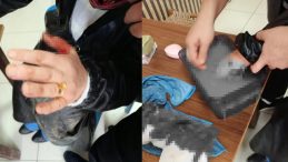 Diyarbakır'da Başıboş Sokak K&ouml;peği Dehşet Sa&ccedil;tı: 2 Kişi Yaralandı