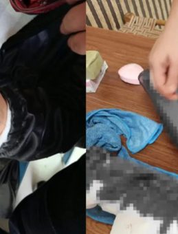 Diyarbakır'da Başıboş Sokak Köpeği Dehşet Saçtı: 2 Kişi Yaralandı