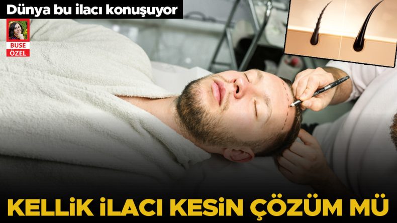 D&uuml;nya Bu İla&ccedil;la Tanışıyor: Kelliğe Umut Veren Merhem