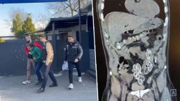 Fas'tan T&uuml;rkiye'ye midesinde getirdi! Ameliyatla &ccedil;ıkarıldıktan sonra tutuklandı