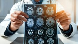 İnmede Yanlış M&uuml;dahale Hayatları Tehlikeye Atıyor: Bu İlacı Kesinlikle Vermeyin!