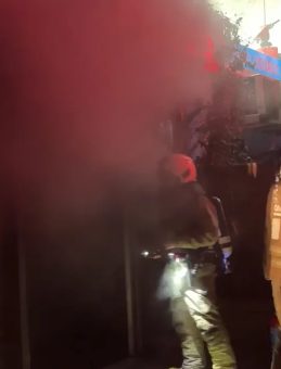 Kağıthane’de Feci Yangında Vücudu Yanmıştı: 15 Yaşındaki Engin 65 Ameliyat Geçirdi! 'Ben Yılmadım'