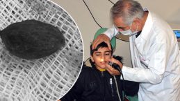 Kaşıntı Şikayetiyle Hastaneye Gitti: Burnundan &Ccedil;ıkanlar Ailesini Şaşırttı!