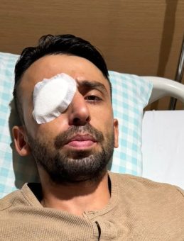 K&ouml;r Eden Kurşuna 4,5 Yıla Kadar Hapis İstendi