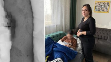 Okulda Akran Zorbalığı: 9 Yaşındaki &Ccedil;ocuk Arkadaşının Kolunu İki Yerinden Kırdı!