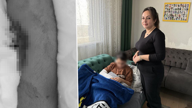 Okulda Akran Zorbalığı: 9 Yaşındaki &Ccedil;ocuk Arkadaşının Kolunu İki Yerden Kırdı!