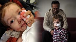 SON DAKİKA&hellip; Ankara&rsquo;da pitbull saldırısına uğrayan 1,5 yaşındaki Efe &Ouml;zt&uuml;rk&rsquo;ten yeni haberler geldi!