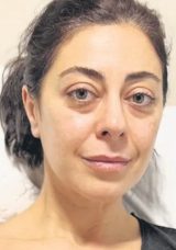Ş&ouml;mine Bomba Gibi Patladı