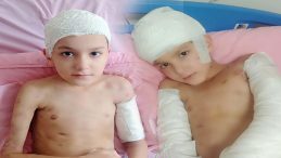 12 Yaşındaki Tunahan'ın Hayatı Kabusa D&ouml;nd&uuml;! Sokak K&ouml;peği Saldırısında Aileye 5 Milyon Lira Tazminat &Ouml;denecek