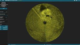 42 Kişinin Hayatını Kaybettiği U&ccedil;akla İlgili 50 Yıl Sonra Bir Gelişme