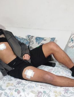 Adana'da 15 Yaşındaki Çocukların Zorbalığı: Ölüme Yaklaşan Bir Olay!