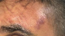 Afyonkarahisar'da Dehşet Anları: İş Yeri Sahibi D&uuml;kkanında &Ouml;ld&uuml;resiye Darp Edildi!