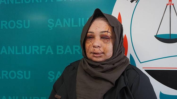 Ankara'da Kadına Şiddete Y&ouml;nelik Tutuklama: Bakan Tun&ccedil; ve G&ouml;ktaş'tan A&ccedil;ıklamalar