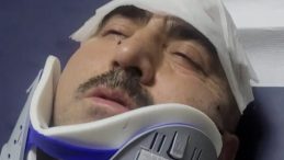 Ankara'da Patron Dehşeti! Sigortasız &Ccedil;alışan İş&ccedil;iyi Patron ve Oğlu Darp Etti