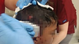 Ankara&rsquo;da Kontrols&uuml;z K&ouml;pek Saldırısı: 8 Yaşındaki &Ccedil;ocuk Yaralandı!