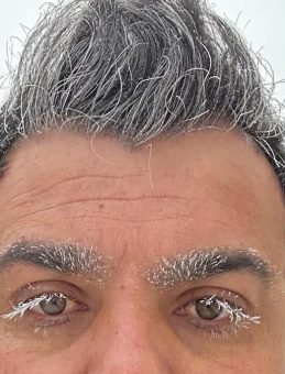 Ardahan Soğuk Havayla M&uuml;cadele Ediyor: Dışarı &Ccedil;ıkanların Kaş ve Kirpikleri Dondu!