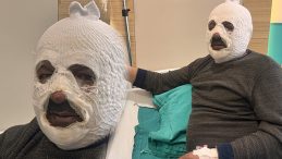 Arkadaşına yardım etmek istedi: Az daha canından oluyordu! 'Ben yandım kimse yanmasın'