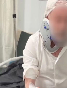 Beylikd&uuml;z&uuml;'nde Skuterli &Ccedil;ocuğa Otomobil &Ccedil;arptı: S&uuml;r&uuml;c&uuml;ye Saldırı!