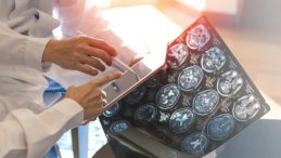 Demans Sadece Yaşlılık Hastalığı Değil: Riskler Yıllar &Ouml;nce Başlayabilir