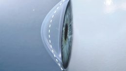 Dikkat G&ouml;zlerini Sık Sık Ovuşturanlara!