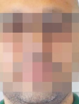 Doktordan Genç Çifte Şiddet