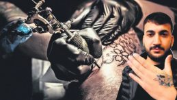 D&ouml;vmesini Sildirmek İsterken Elinden Oldu