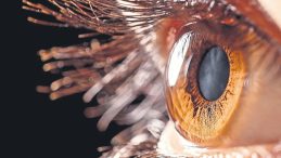 G&ouml;z İ&ccedil;i T&uuml;m&ouml;r&uuml;ne Radyoaktif Plak Tedavisi