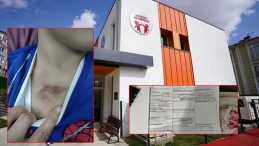 İBB Kreşinde Şok Edici Olay! 3 Yaşındaki &Ccedil;ocuğa Taciz ve Darp İddiası