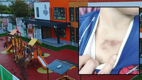 İBB'ye ait kreşteki darp ve istismar iddialarına y&ouml;nelik soruşturmada 1 ş&uuml;pheli tutuklandı