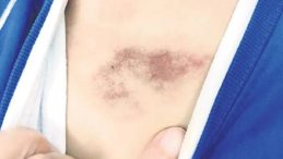 İBB&rsquo;den Kreş Skandalına Tepki &Ccedil;eken Savunma