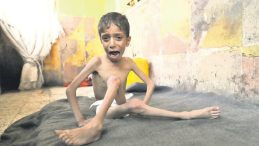 İnsanlığın Vicdanı Gazze'de Donuyor