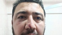 Ke&ccedil;i&ouml;ren Belediyesi'nde Şok Eden Dayak Olayı! "Siz &Ccedil;ete Misiniz, Organize &Ouml;rg&uuml;t M&uuml;?"