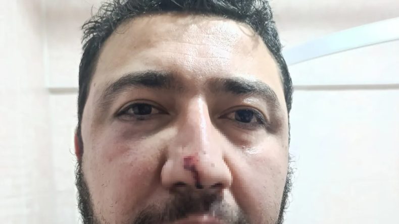 Keçiören Belediyesi'nde Şok Eden Dayak Olayı! "Siz Çete Misiniz, Organize Örgüt Mü?"