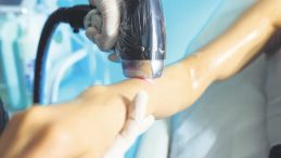 Lazer Epilasyon Sonrası Yanık Skandalı